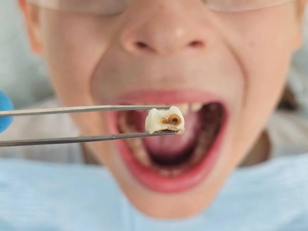 Best Walk-In Emergency Dental Services in Rolesville, NC