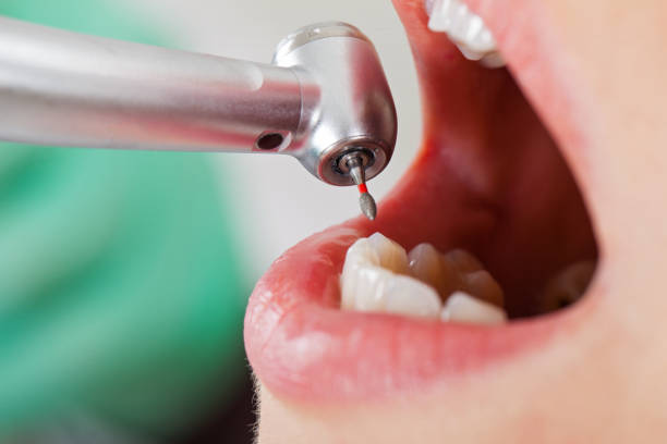 Best Emergency Treatment for Jaw Pain or Injury in Rolesville, NC